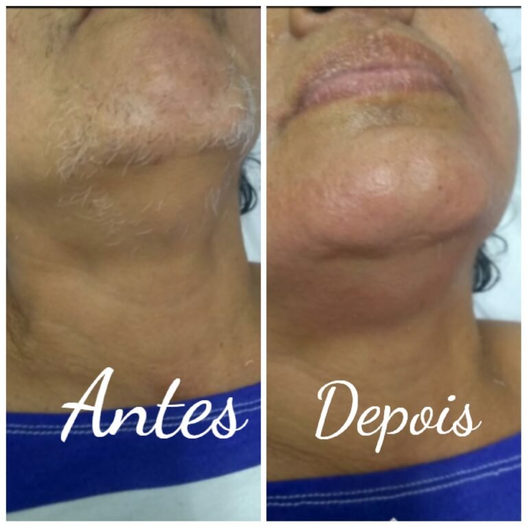 lidow_2020713182556221 - thayciane caldas